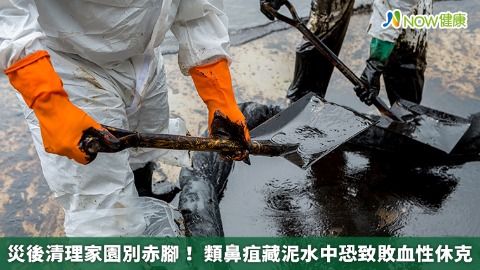 災後清理家園別赤腳！ 類鼻疽藏泥水中恐致敗血性休克