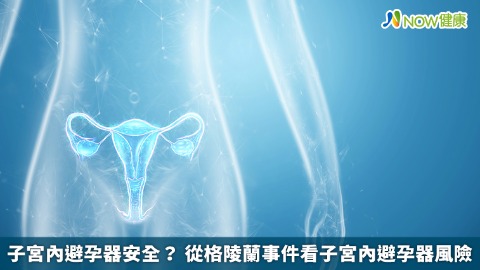 子宮內避孕器安全？ 從格陵蘭事件看子宮內避孕器風險