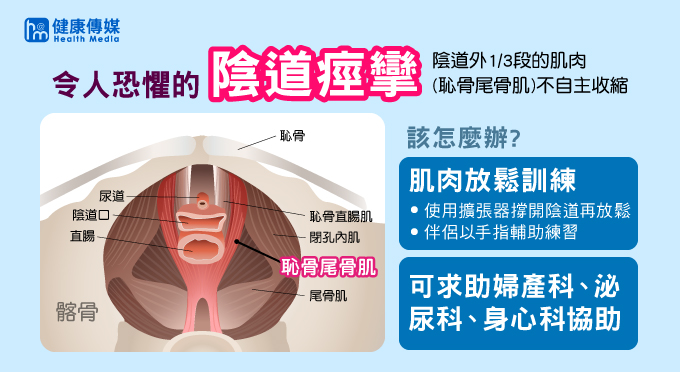 陰道痙攣是指陰道外三分之一段的肌肉不自主痙攣性收縮，這種收縮會發生在想像或真正的陰莖插入，進而影響到正常的性生活。（圖／健康傳媒製圖）